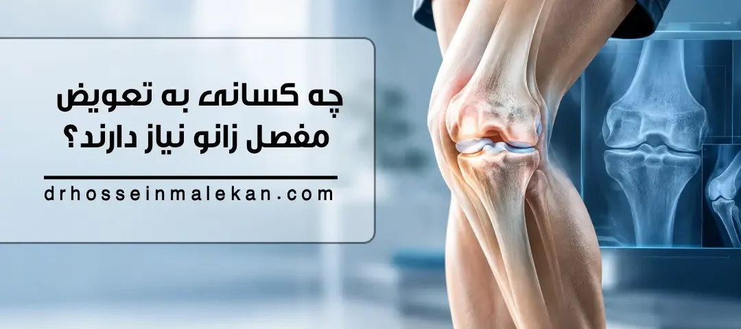 چه کسانی به تعویض مفصل زانو نیاز دارند