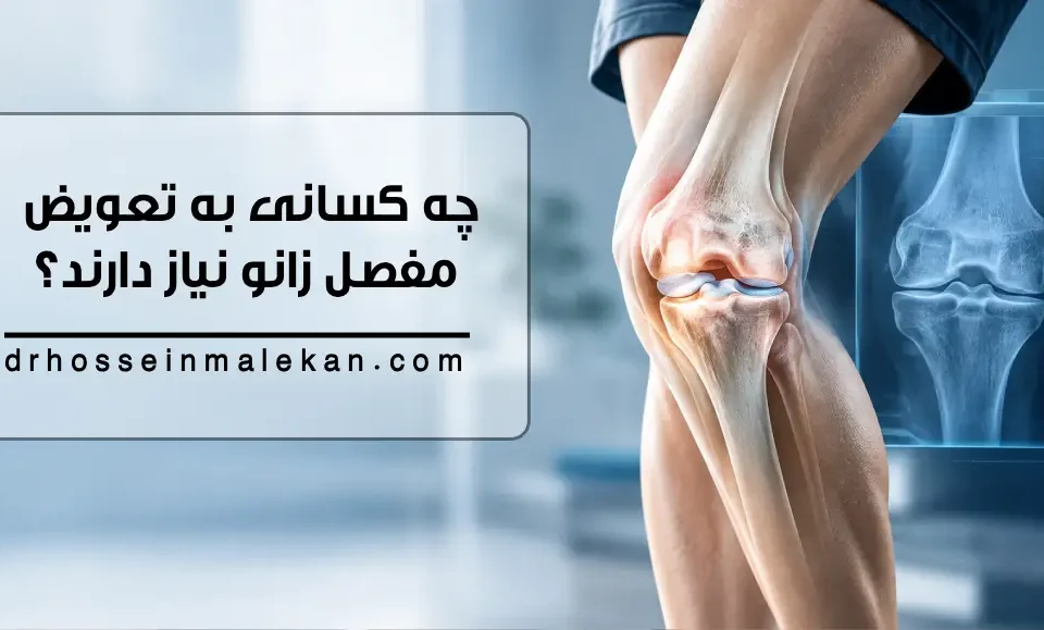 چه کسانی به تعویض مفصل زانو نیاز دارند