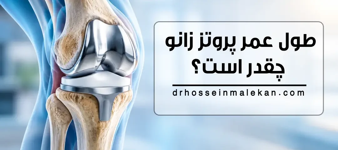 طول عمر پروتز زانو چقدر است؟