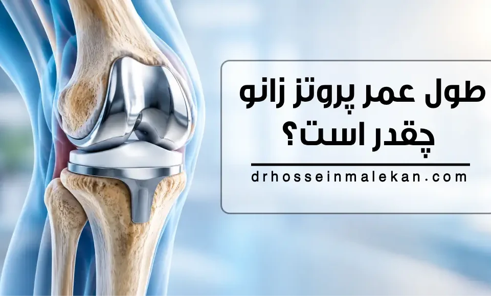 طول عمر پروتز زانو چقدر است؟